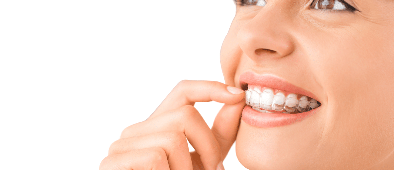 Quick Straight Teeth
