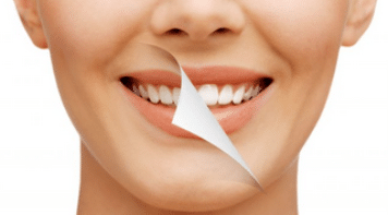 Restorative Dentistry